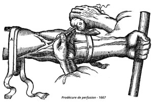 Perfusion 1667