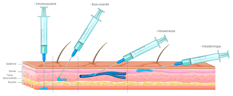 RÃ©sultat de recherche d'images pour "injections intramusculaire sous-cutanÃ©e intraveineuse"